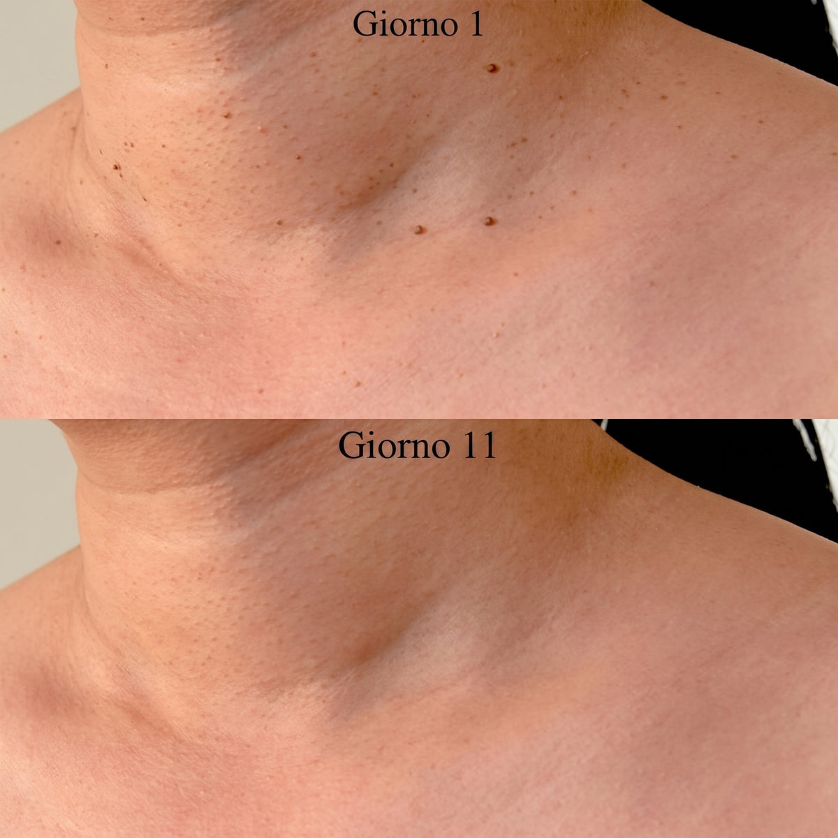 Kit Elevyas – Addio fibromi penduli
