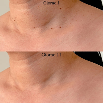 Kit Elevyas – Addio fibromi penduli